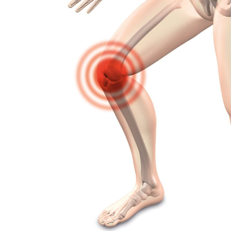 Why do my knees crack every time I squat? Why do my knees crack every time I squat?